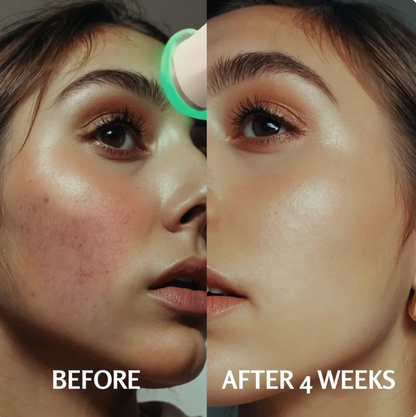 PureO2 - Bioactive Delivery MicrOxygenation